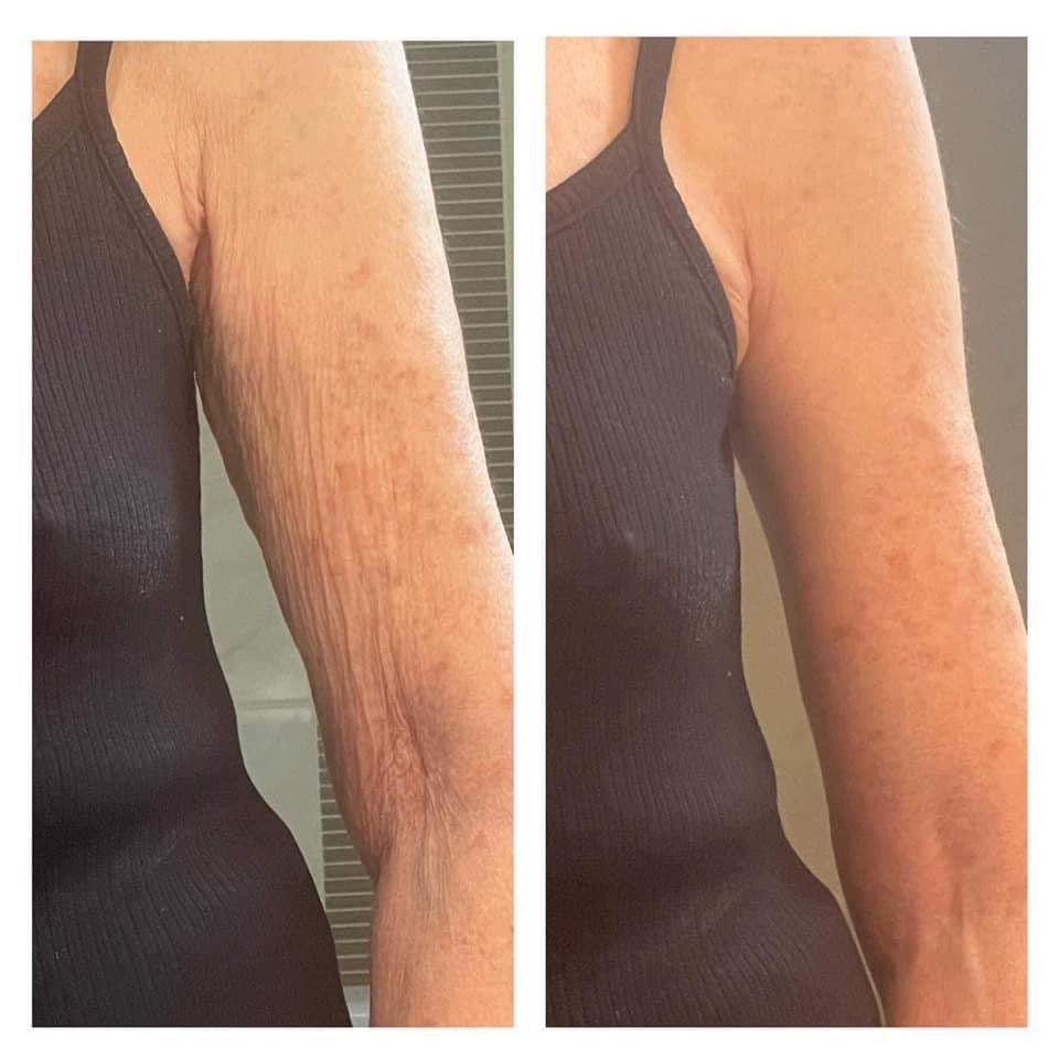 Firm & Tan bundle - Batavia Beauty