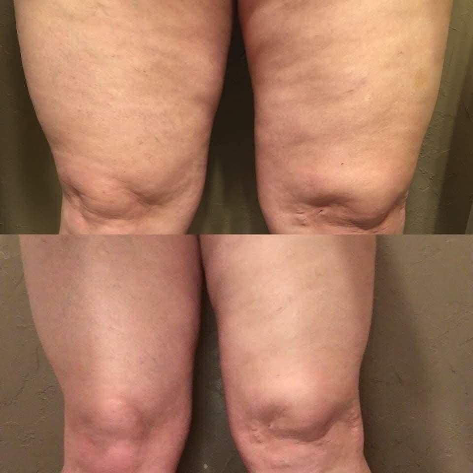 ageLOC® Dermatic Effects⢠Body Contouring Lotion - Batavia Beauty