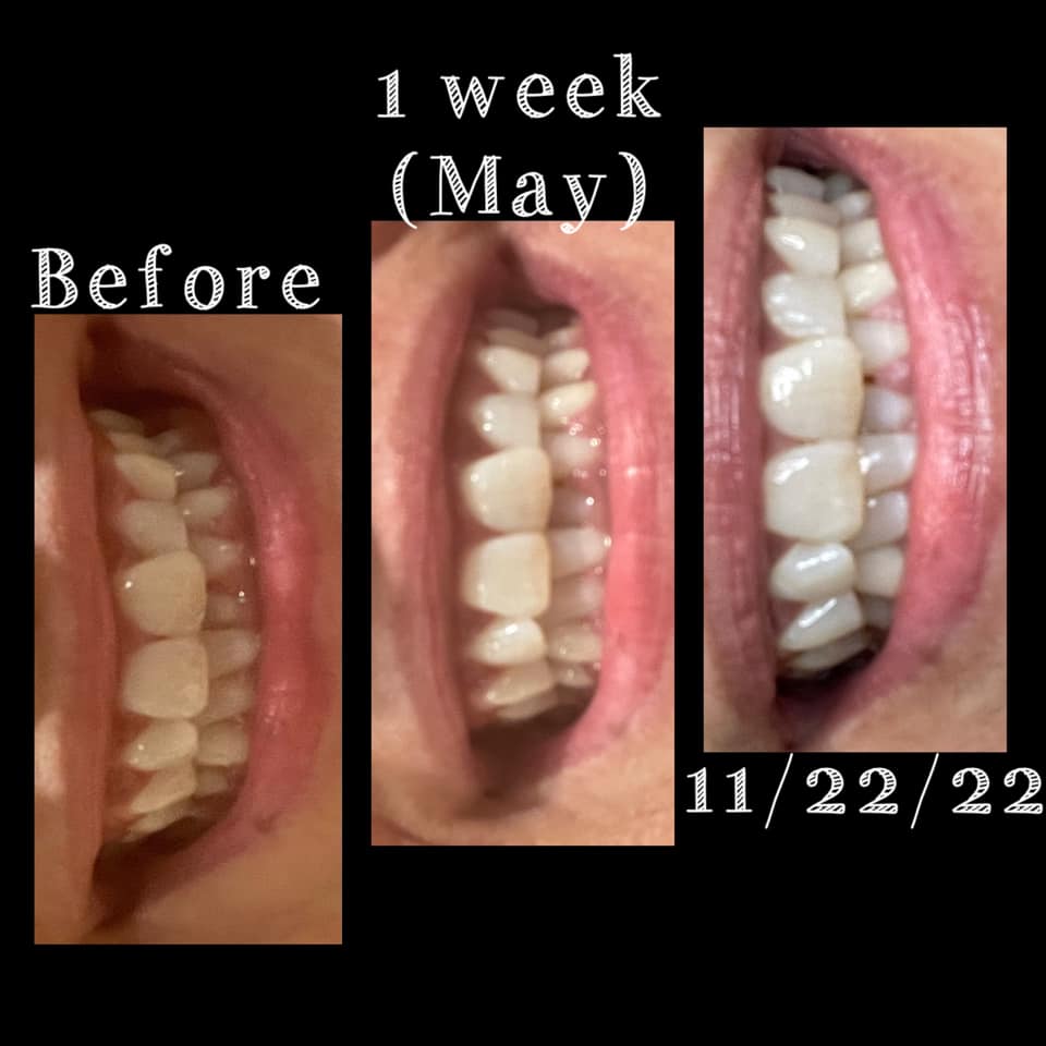 AP 24® Whitening Fluoride Toothpaste - Batavia Beauty