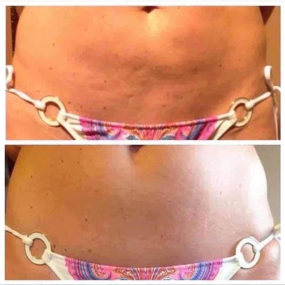 ageLOC® Dermatic Effects⢠Body Contouring Lotion - Batavia Beauty