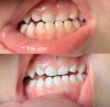 AP 24® Whitening Fluoride Toothpaste - Batavia Beauty