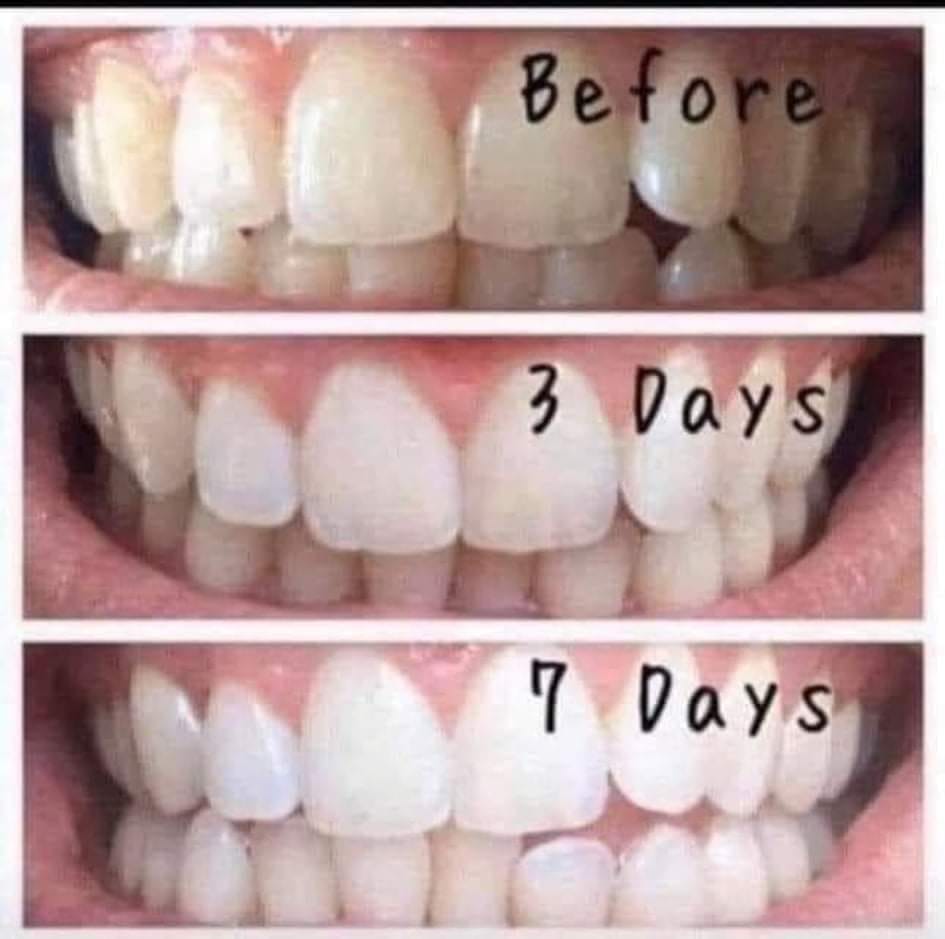 AP 24® Whitening Fluoride Toothpaste - Batavia Beauty