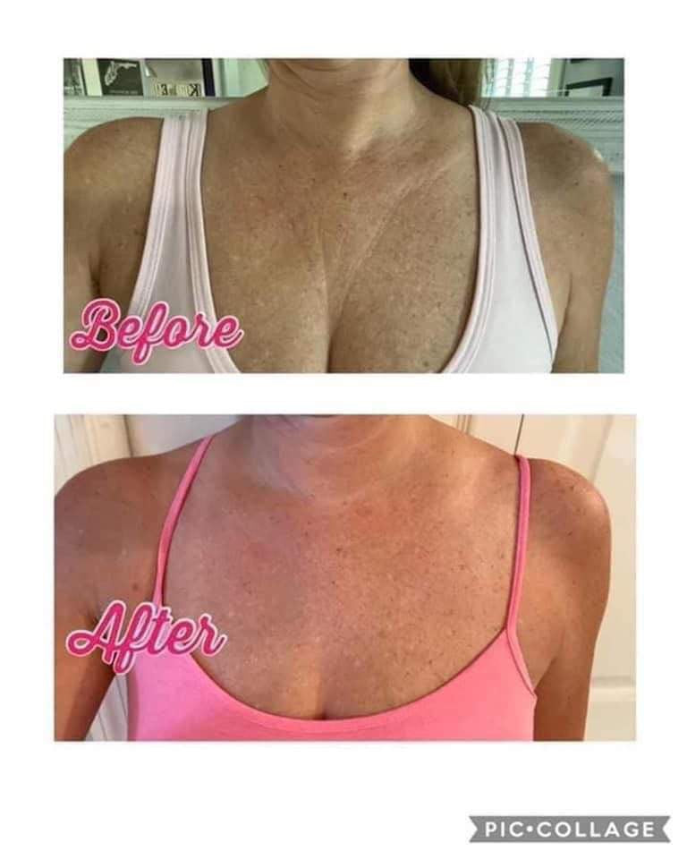 ageLOC® Dermatic Effects⢠Body Contouring Lotion - Batavia Beauty