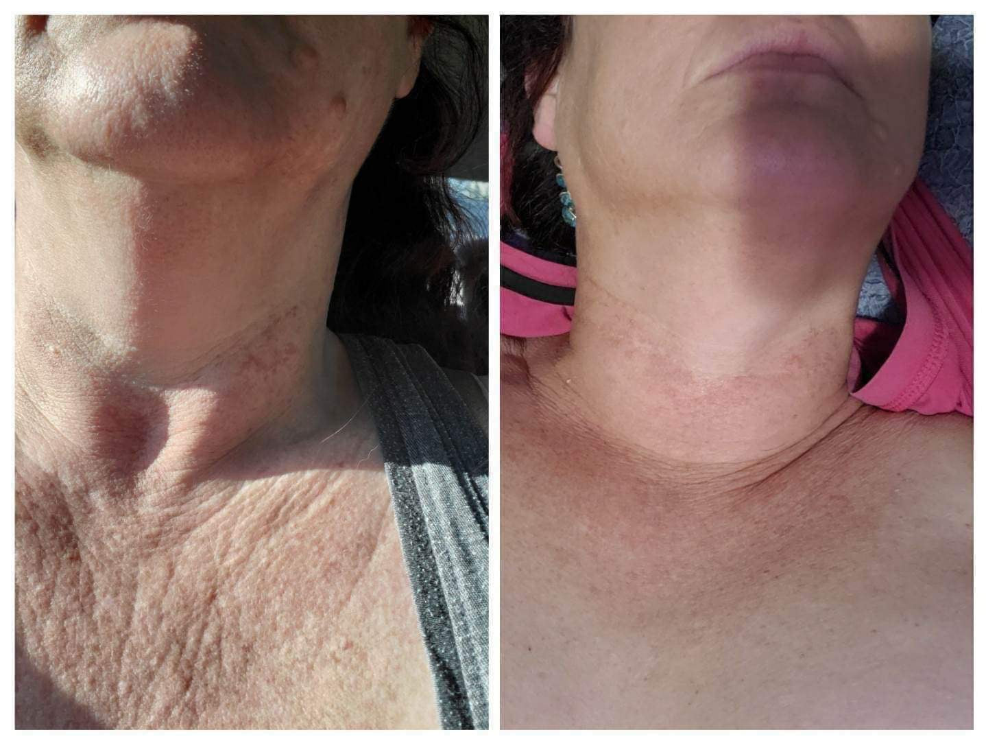 ageLOC® Dermatic Effects⢠Body Contouring Lotion - Batavia Beauty