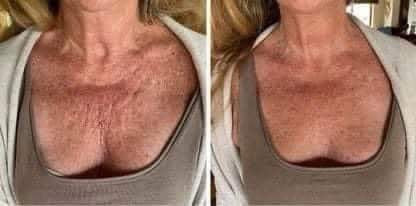 ageLOC® Dermatic Effects⢠Body Contouring Lotion - Batavia Beauty