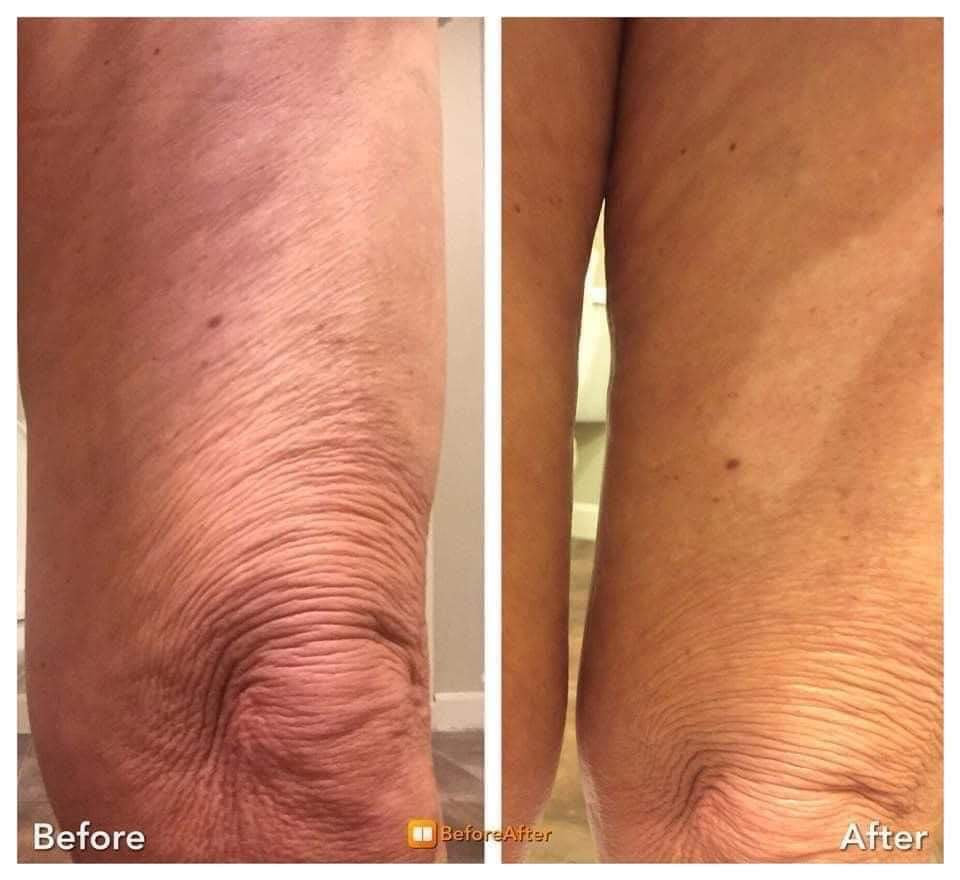 ageLOC® Dermatic Effects⢠Body Contouring Lotion - Batavia Beauty