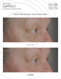 ageLOC LumiSpa IdealEyes - Batavia Beauty