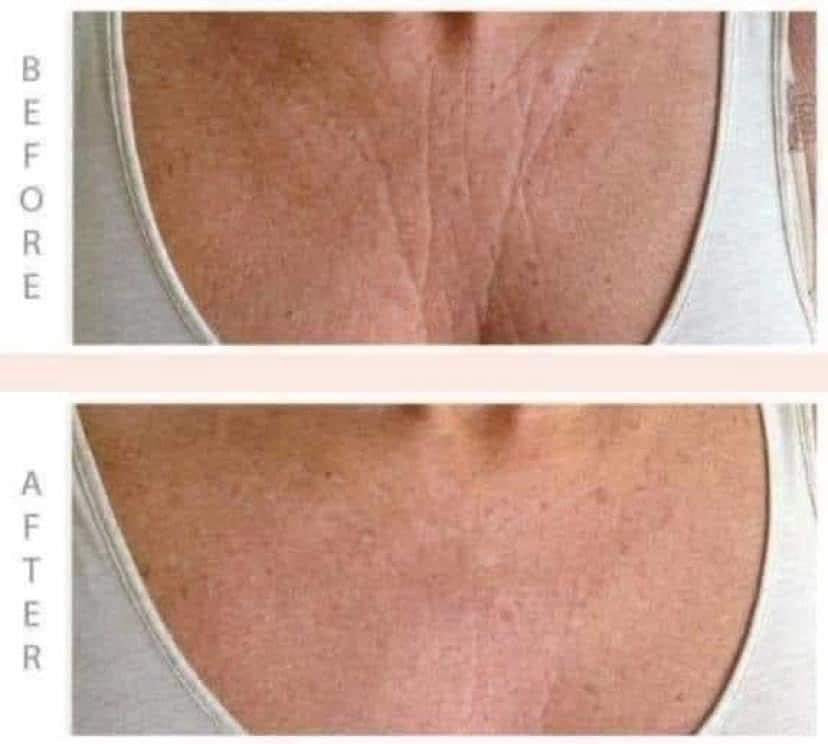 ageLOC® Dermatic Effects⢠Body Contouring Lotion - Batavia Beauty