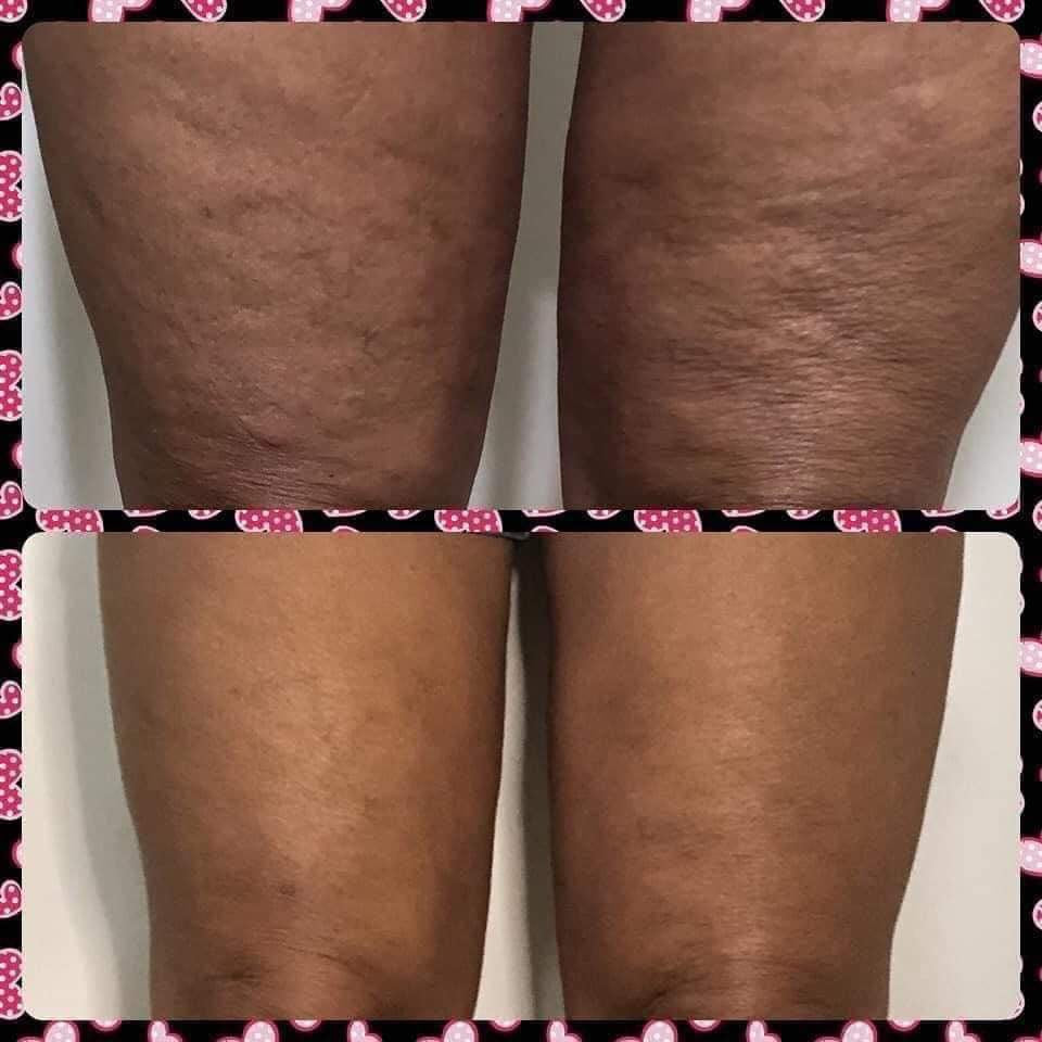 ageLOC® Dermatic Effects⢠Body Contouring Lotion - Batavia Beauty