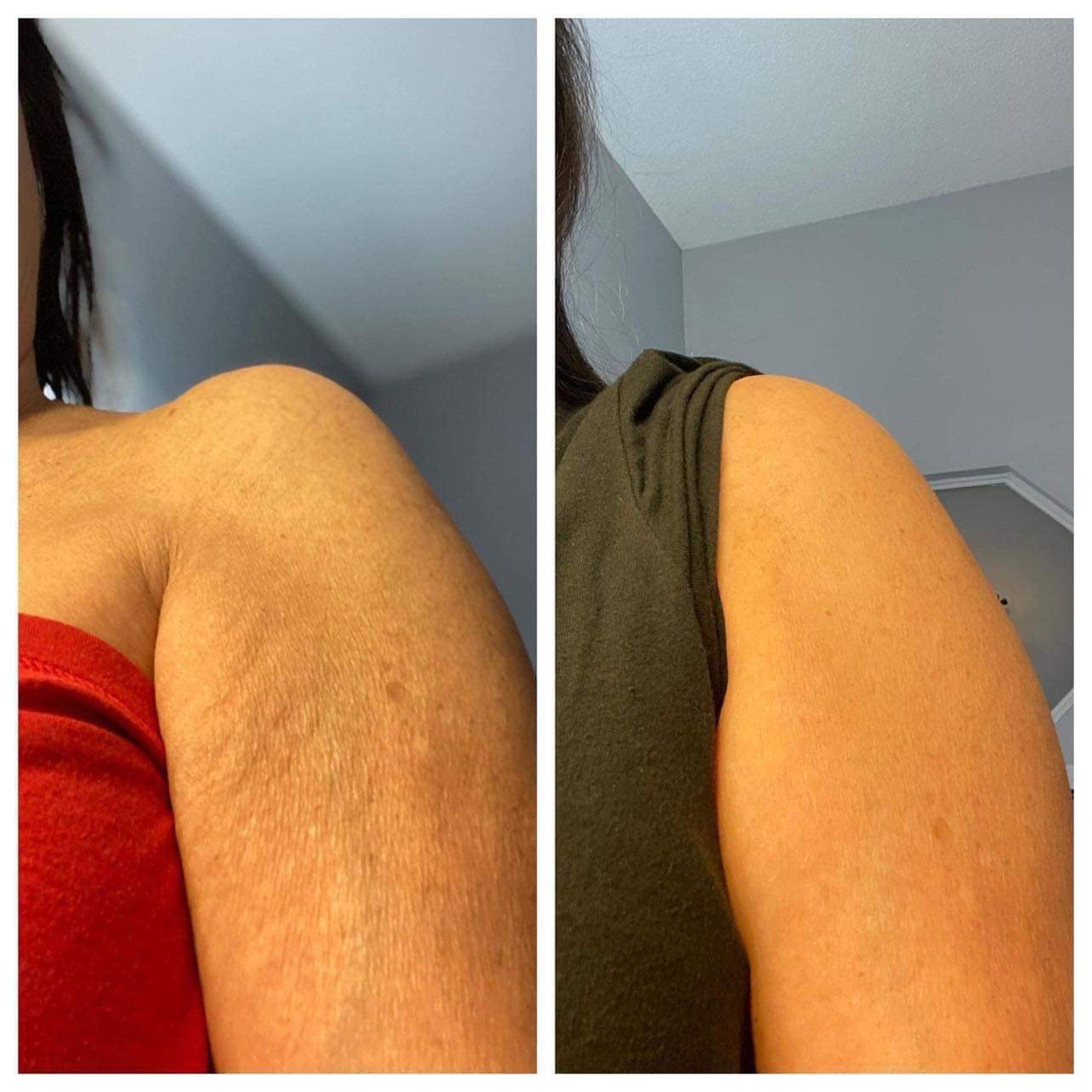 ageLOC® Dermatic Effects⢠Body Contouring Lotion - Batavia Beauty