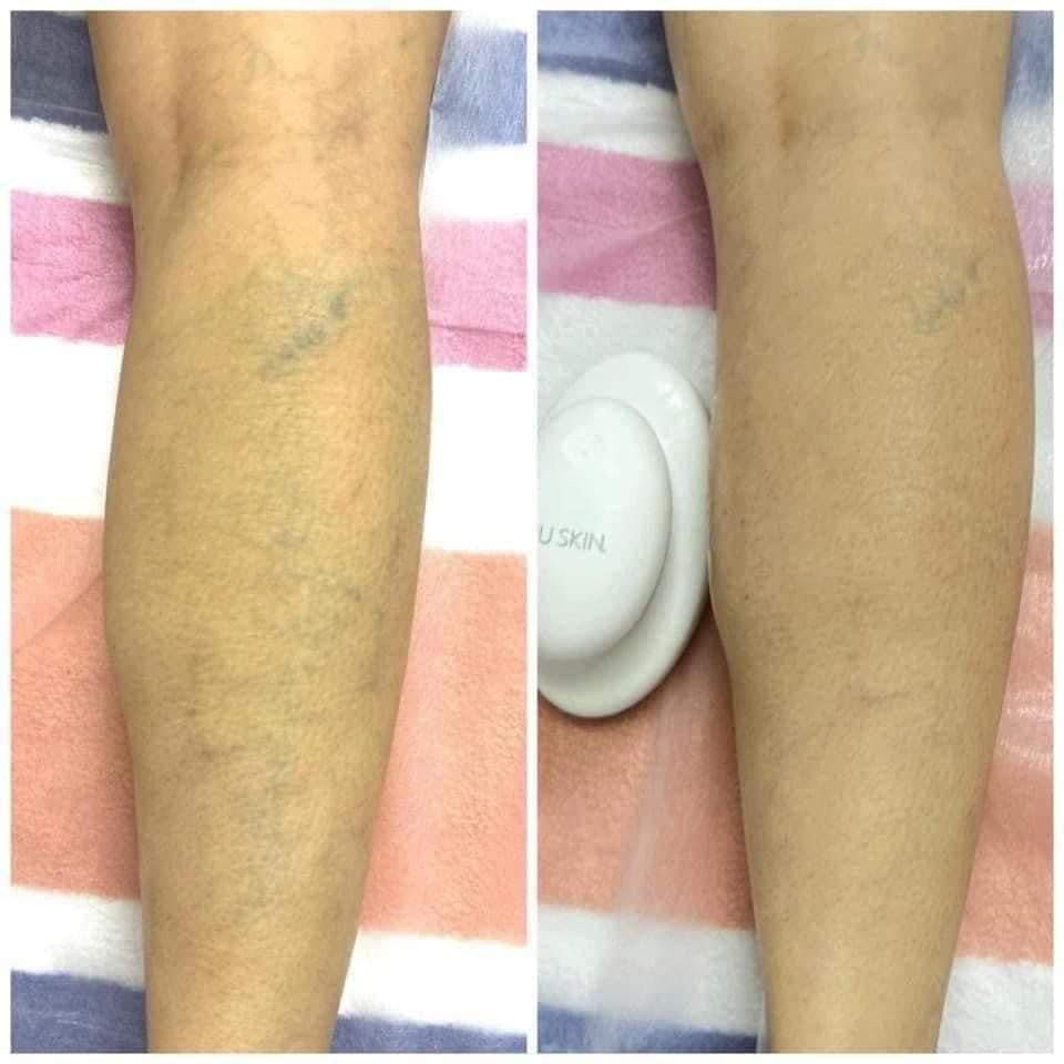 Nu Skin® RenuSpa iO™ - Batavia Beauty