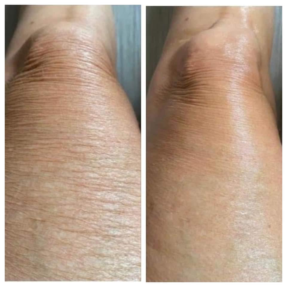Nu Skin® RenuSpa iO™ - Batavia Beauty
