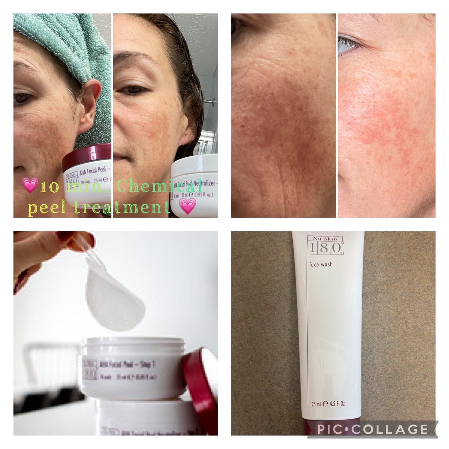 180° AHA Facial Peel and Neutralizer - Batavia Beauty