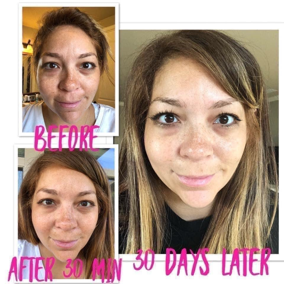 ageLOC® Tru Face® Essence Ultra Uplifting Cream - Batavia Beauty