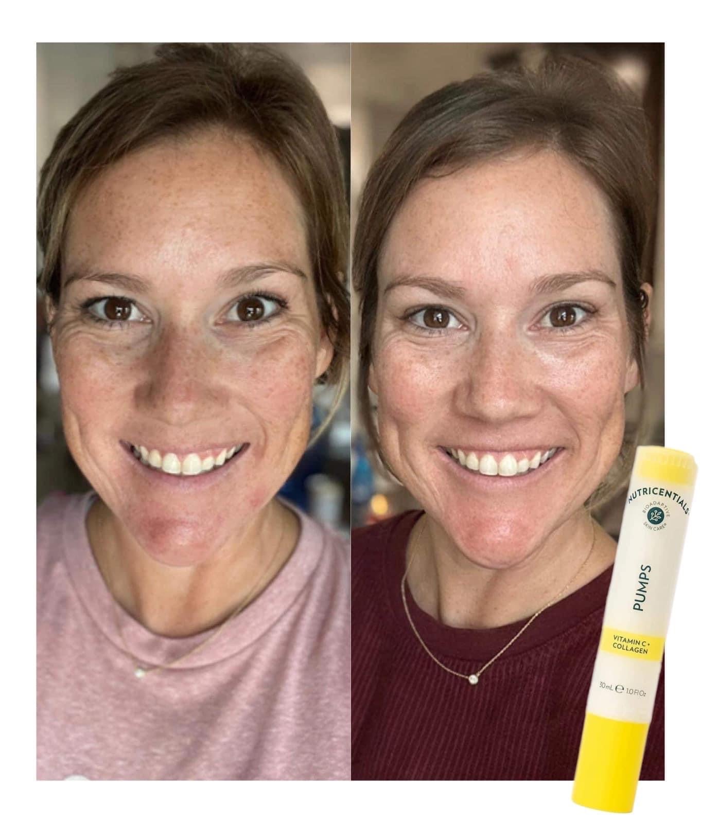 Nutricentials® Vitamin C + Collagen Pump - Batavia Beauty