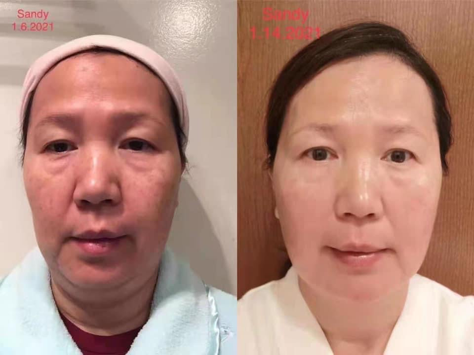 ageLOC® Tru Face® Essence Ultra Uplifting Cream - Batavia Beauty