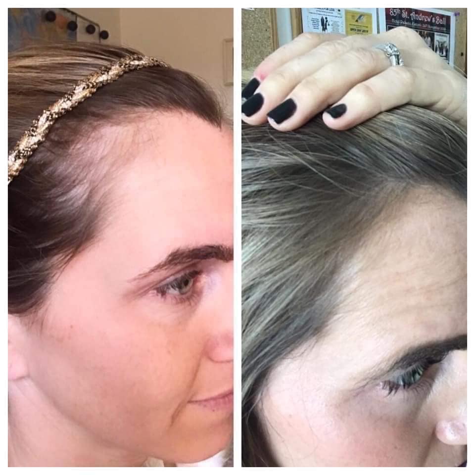 Scalp & Hair System Kit - Batavia Beauty