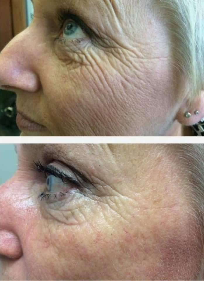 ageLOC® Tru Face® Essence Ultra Uplifting Cream - Batavia Beauty