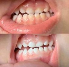 AP 24® Whitening Fluoride Toothpaste - Batavia Beauty 