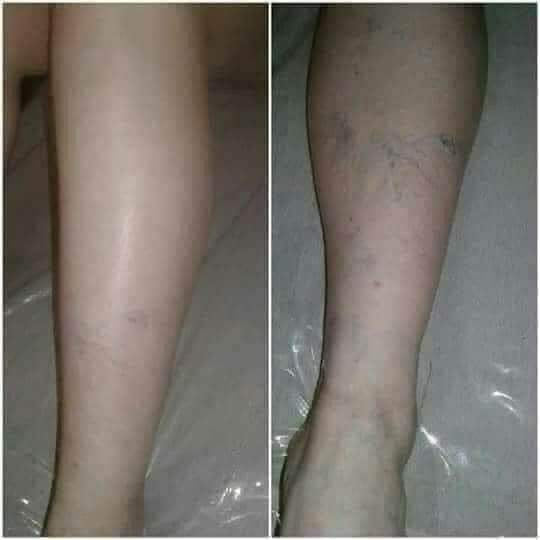 Epoch® IceDancer® Invigorating Leg Gel - Batavia Beauty 
